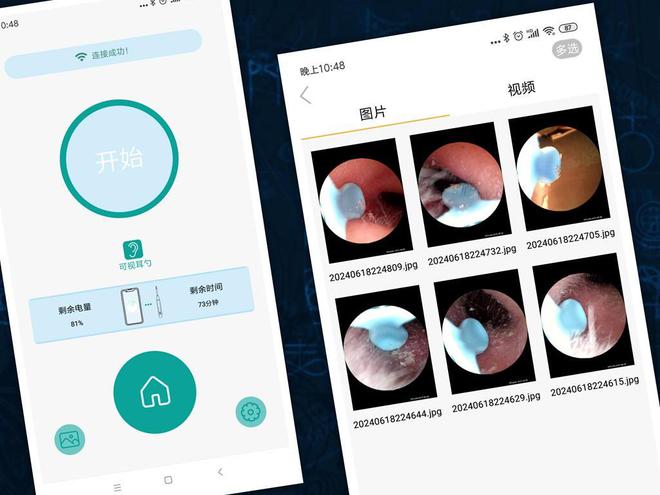 可视耳勺、专业洁耳：西圣find智能可视耳勺(图9)