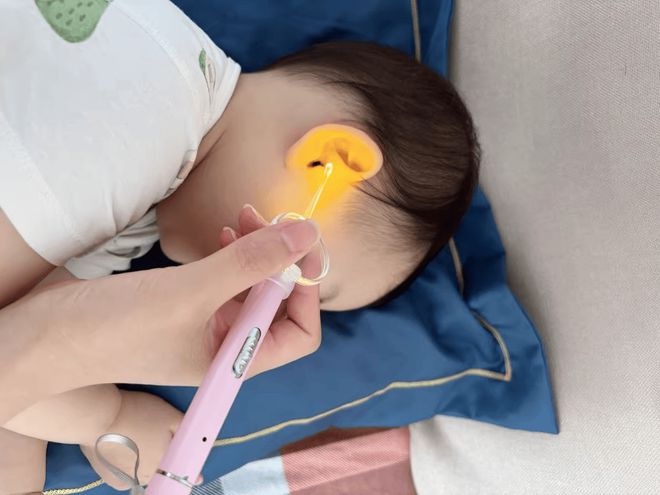 掏耳神器哪种最好用？力荐四款精品挖耳神器(图2)