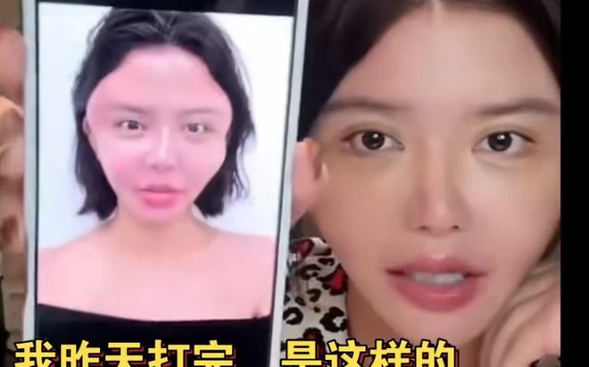 自曝硅胶不母乳网红的畸形审美在韩安冉身上表现得淋漓尽致(图7)