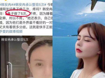 自曝硅胶不母乳网红的畸形审美在韩安冉身上表现得淋漓尽致(图8)