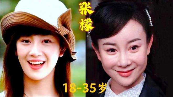 6大整容女星“车祸现场”个个硅胶乱飞你认为哪位反差较大？(图7)