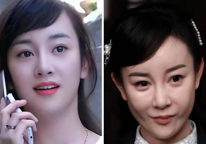 6大整容女星“车祸现场”个个硅胶乱飞你认为哪位反差较大？(图8)