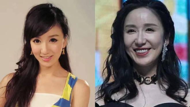 6大整容女星“车祸现场”个个硅胶乱飞你认为哪位反差较大？(图11)