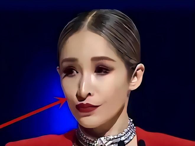 6大整容女星“车祸现场”个个硅胶乱飞你认为哪位反差较大？(图14)