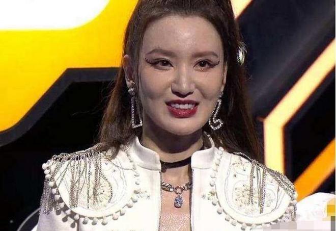 6大整容女星“车祸现场”个个硅胶乱飞你认为哪位反差较大？(图19)