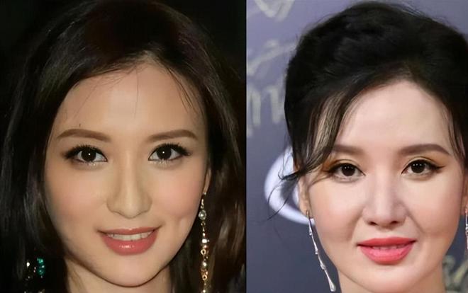 6大整容女星“车祸现场”个个硅胶乱飞你认为哪位反差较大？(图20)