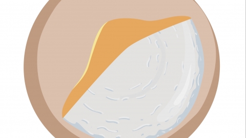 假体是硅胶吗(图1)