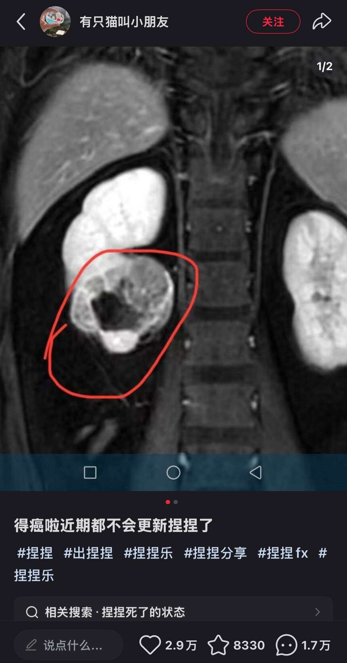 解压“捏捏”或甲醛超标博主自曝患癌停止更新引安全担忧(图1)