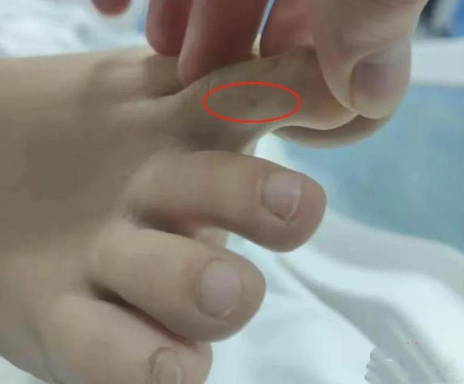 27岁女孩三亚被毒蛇咬身亡好友道出更多细节救助博主涨粉百万(图3)