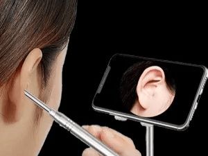 2025年10款高性价比可视挖耳勺推荐：什么牌子可视挖耳勺比较好？(图18)