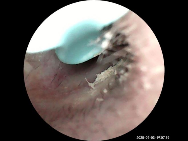 你真会掏耳朵吗?可视化耳勺应该怎么选?拿西圣FindX开刀评测(图8)