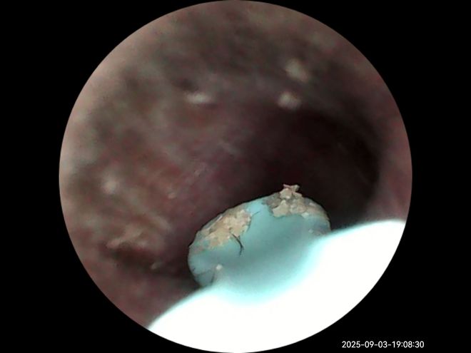 你真会掏耳朵吗?可视化耳勺应该怎么选?拿西圣FindX开刀评测(图11)