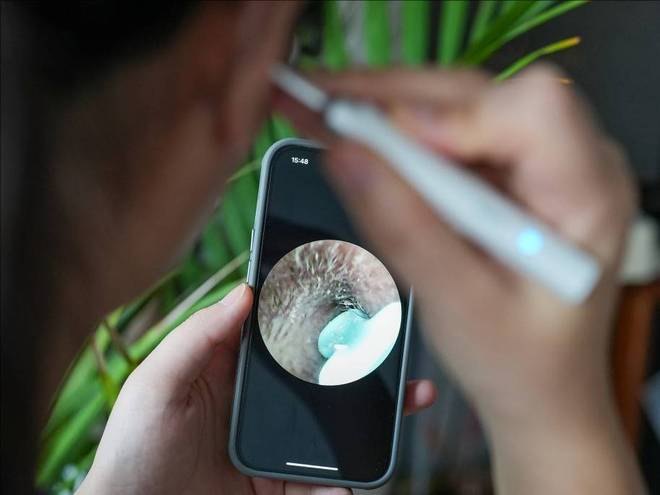 最好用的掏耳勺是哪种？2025年可视掏耳勺十大推荐全整理！(图3)