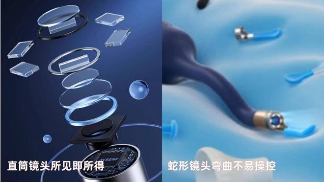 必看！十大公认最好可视挖耳勺盘点哪个牌子最值得入手？(图2)