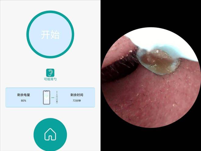 必看！十大公认最好可视挖耳勺盘点哪个牌子最值得入手？(图10)