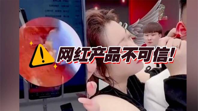 可视掏耳勺哪种好？2025可视掏耳勺10款高性价比推荐(图2)