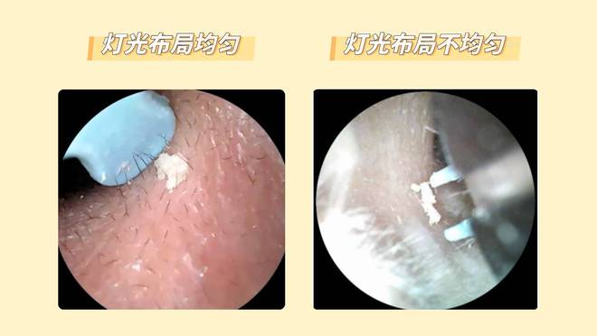 可视掏耳勺哪种好？2025可视掏耳勺10款高性价比推荐(图3)