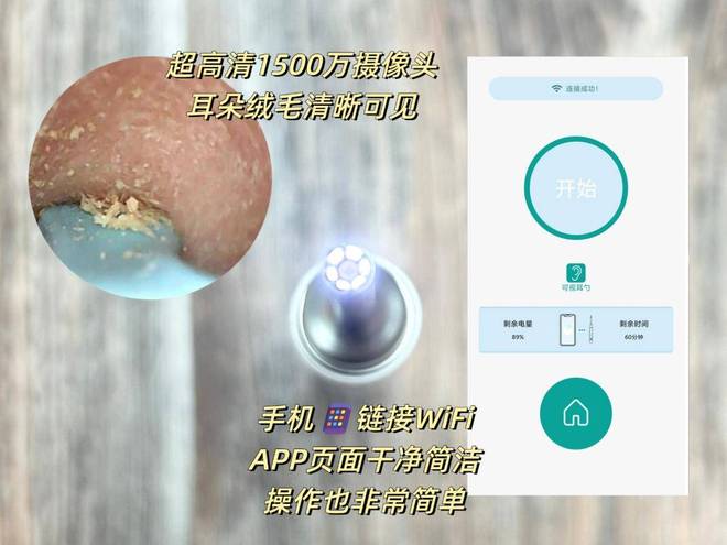 可视掏耳勺哪种好？2025可视掏耳勺10款高性价比推荐(图9)