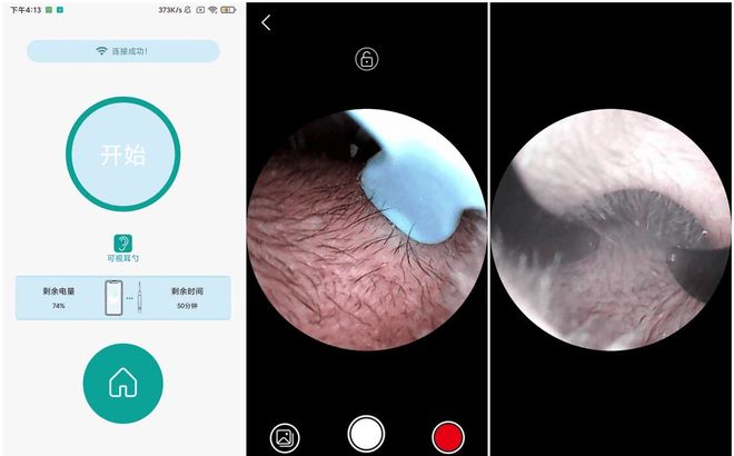 可视掏耳勺哪种好？2025可视掏耳勺10款高性价比推荐(图11)
