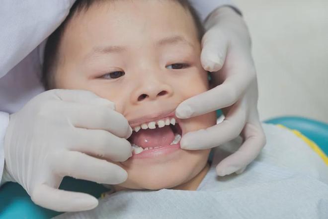 因为一个坏习惯多少人“失去了下巴”(图4)