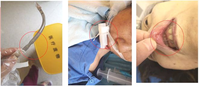 这3种简单实用的创新小发明又获得了国家实用新型专利！(图3)