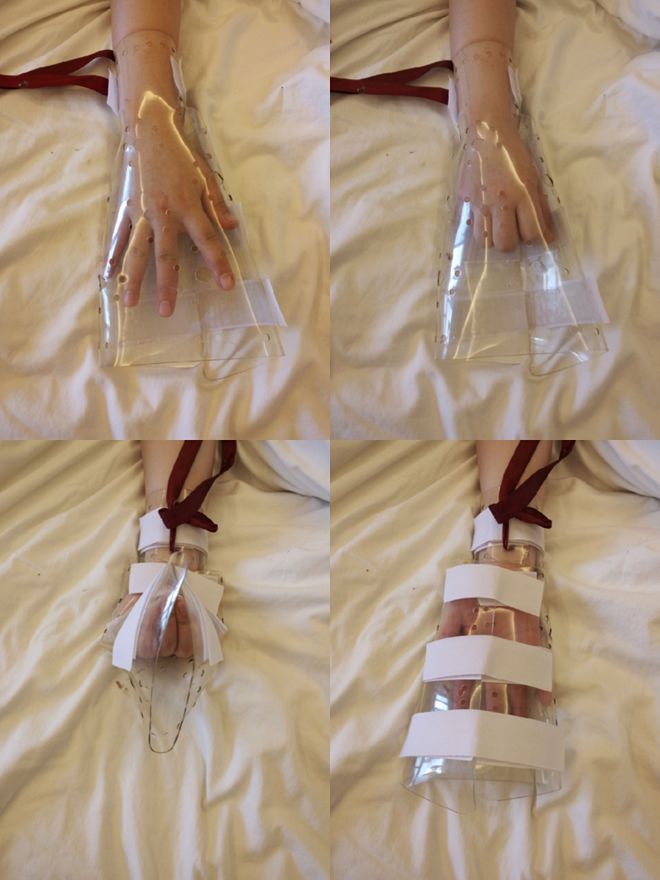 这3种简单实用的创新小发明又获得了国家实用新型专利！(图2)